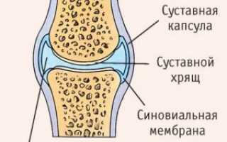 Хронический синовит: почему появляется? Симптомы, диагностика, лечение