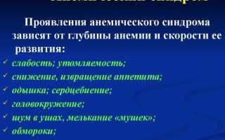 Вся информация про анемический синдром