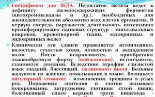Узнаем все про сидеропенический синдром