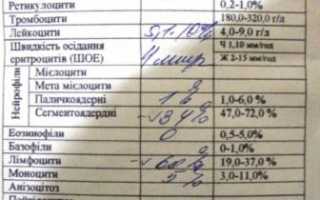 Какие показатели в общем анализе крови могу указывать на онкологию