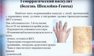 Особенности геморрагического васкулита у детей