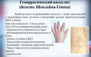 Особенности геморрагического васкулита у детей
