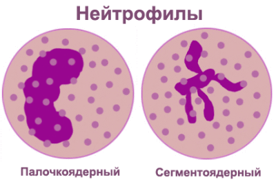 Нейтрофилы